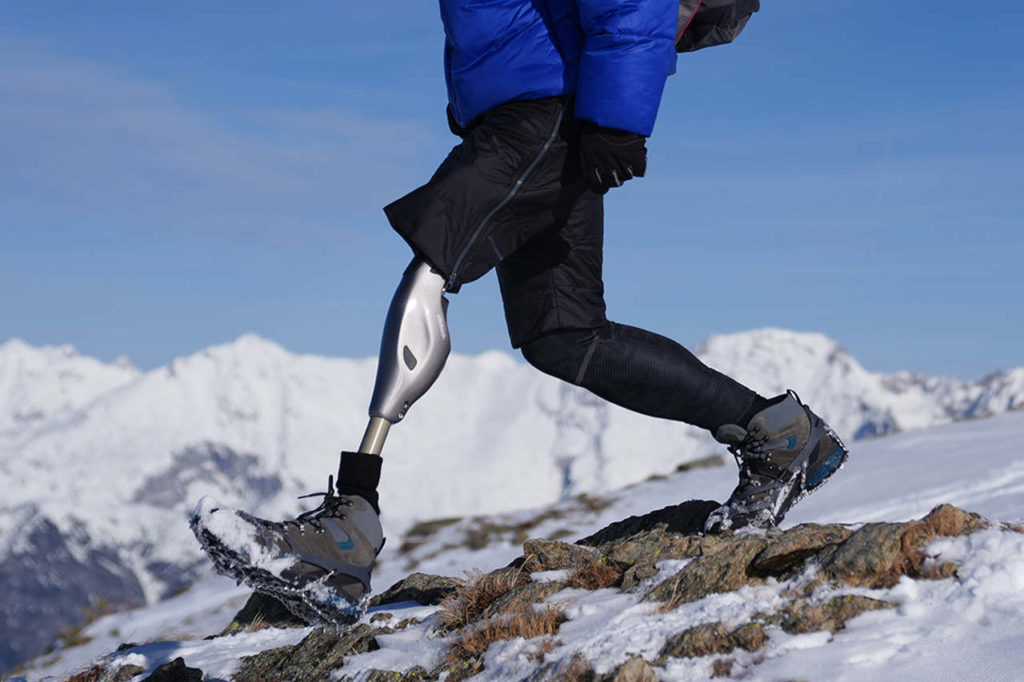 Maximale Mobilität: Ein Wanderer mit Beinprothese steht erfolgreich auf einem schneebedeckten Berggipfel.