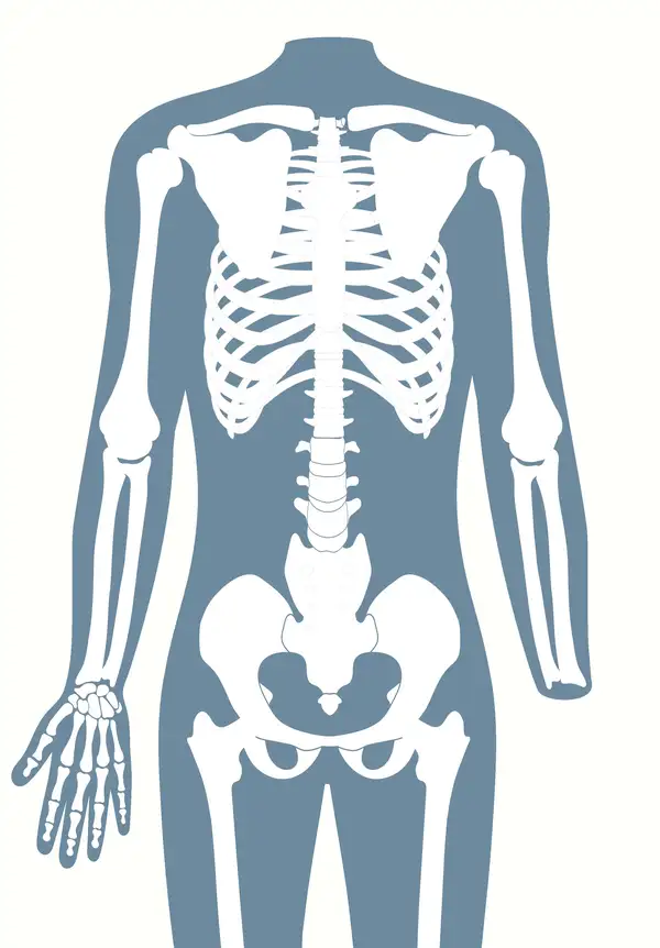 Anatomische Darstellung eines menschlichen Skeletts, das eine Handgelenksexartikulation (Handamputation) zeigt.