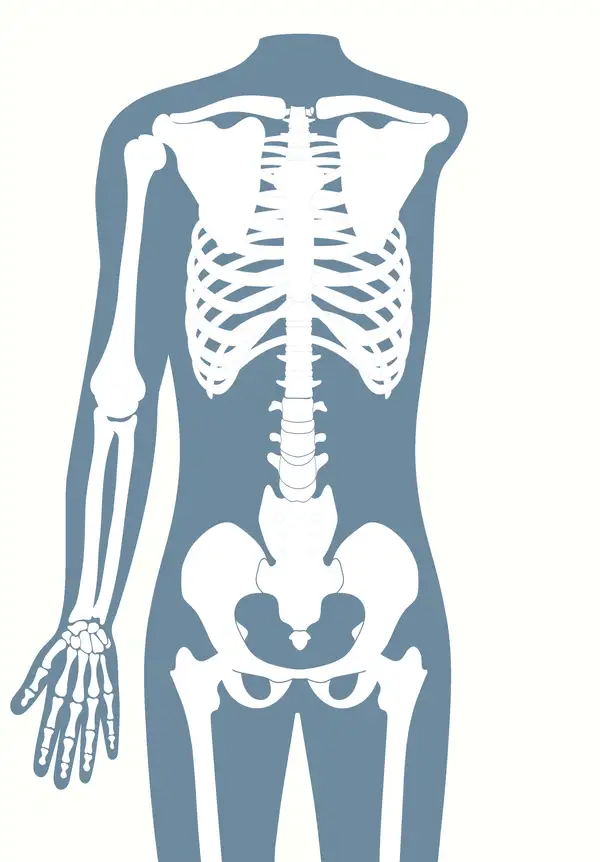Anatomische Darstellung eines menschlichen Skeletts, das eine Schulterexartikulation (Schulteramputation) zeigt.