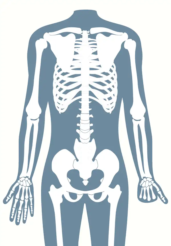 Anatomische Darstellung eines menschlichen Skeletts, das eine Teilhandamputation zeigt.